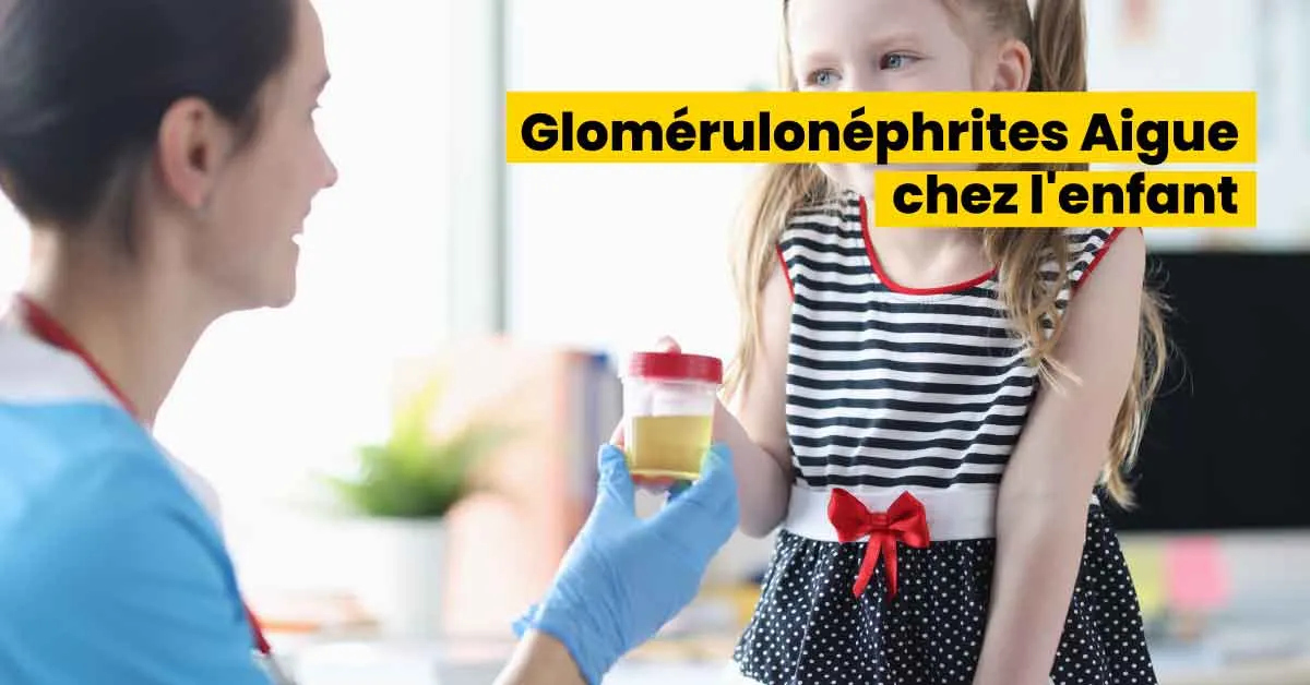  Glomérulonéphrites Aigue chez l'enfant